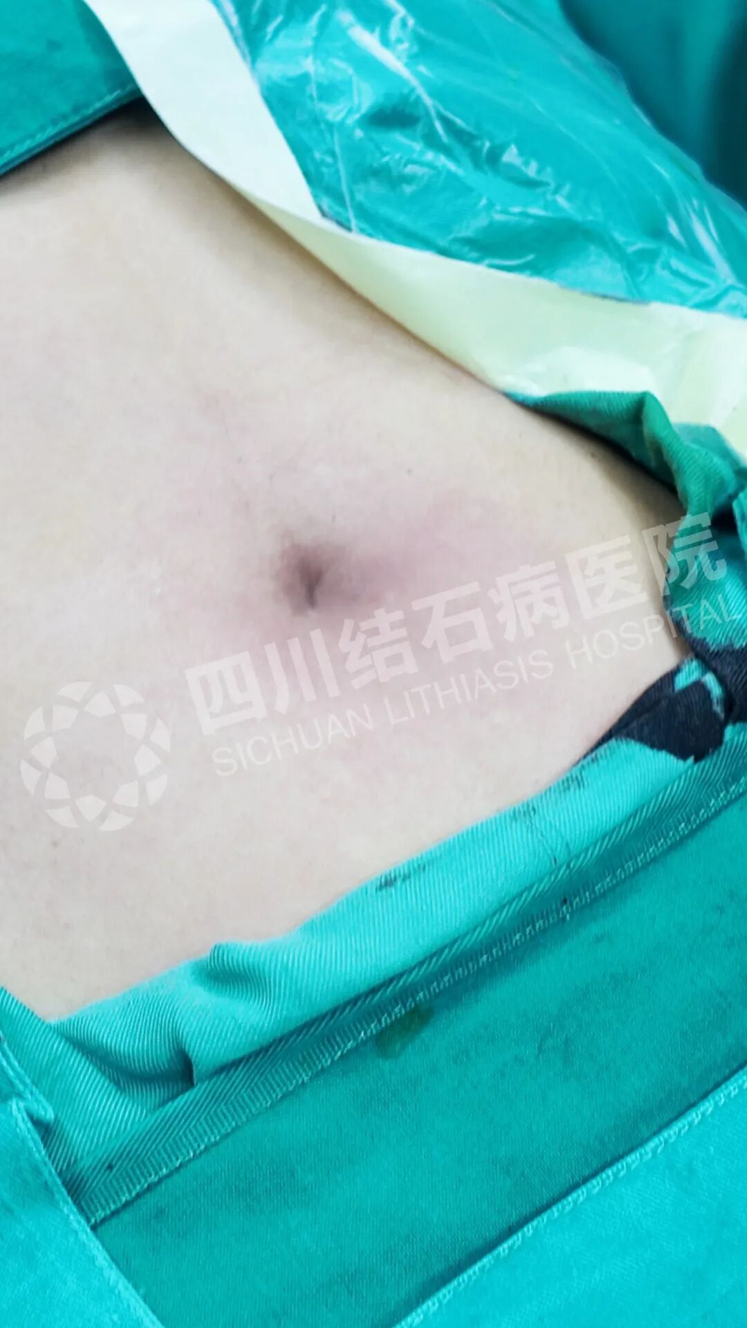 隐痕1.jpg