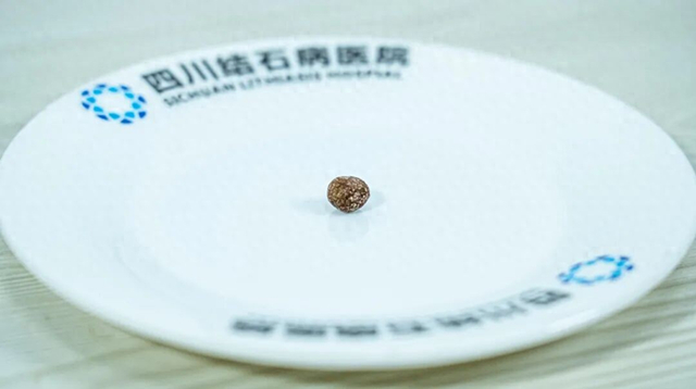 8b42d201f07b4455b83378cf54237807_tplv-tt-origin-web_gif.jpg