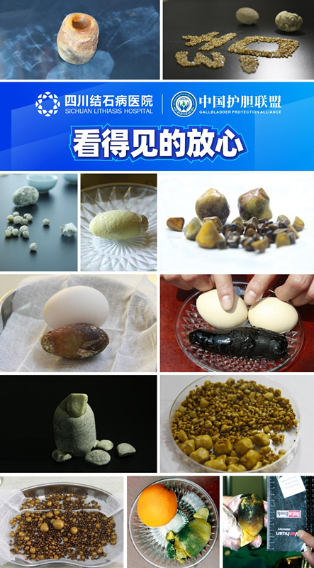 6266e75c226540d499b4a227b4b9ebbc_tplv-tt-origin-web_gif_����.jpg